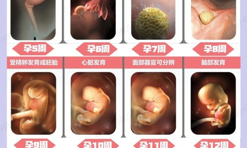黄疸是因为营养不良嘛图片-黄疸影响婴儿发育吗、黄疸与什么有关 -黄疸是因为营养不良嘛网